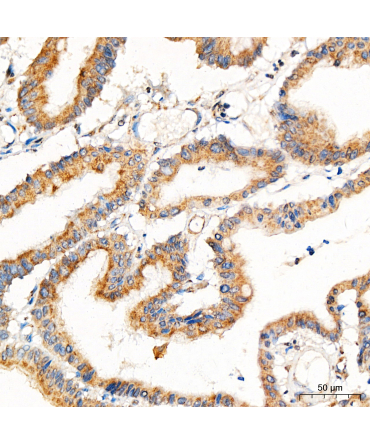 PRELID1 Rabbit Polyclonal Antibody