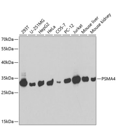 PSMA4 Rabbit Polyclonal Antibody