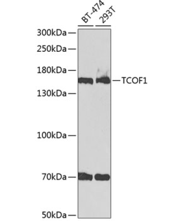 TCOF1 Rabbit Polyclonal Antibody