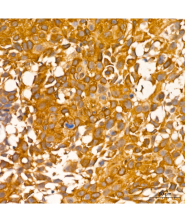 RIP3 Rabbit Polyclonal Antibody
