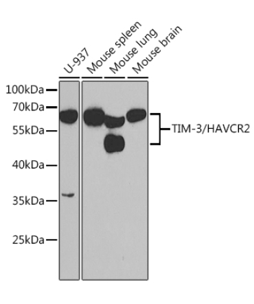 TIM-3/HAVCR2 Rabbit Polyclonal Antibody