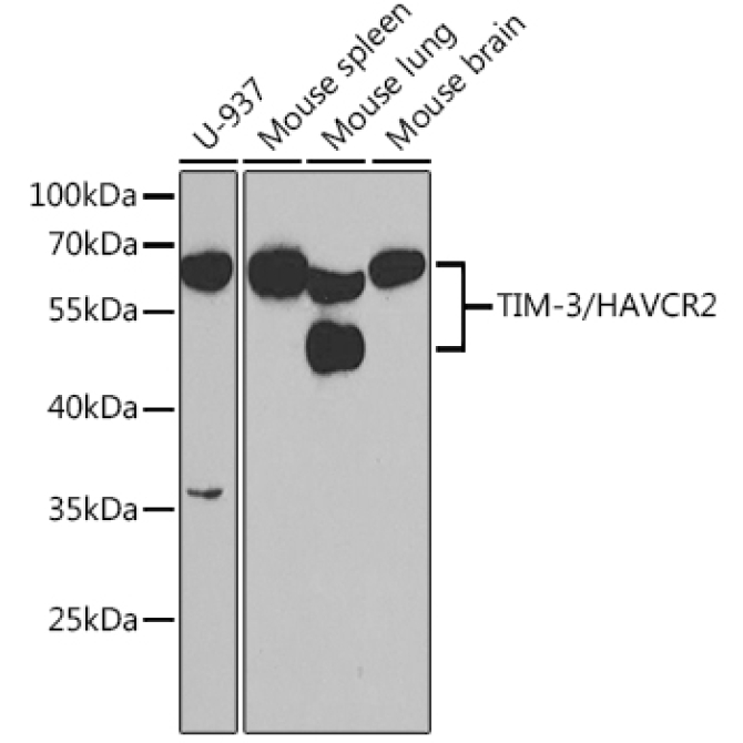 TIM-3/HAVCR2 Rabbit Polyclonal Antibody