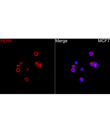 PERK Rabbit Polyclonal Antibody
