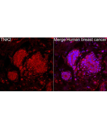 TNK2 Rabbit Polyclonal Antibody