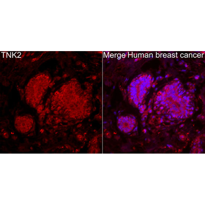 TNK2 Rabbit Polyclonal Antibody