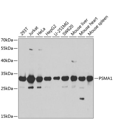 PSMA1 Rabbit Polyclonal Antibody