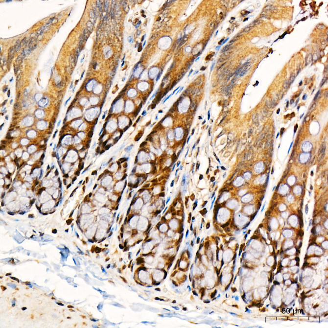 PKR Rabbit Polyclonal Antibody