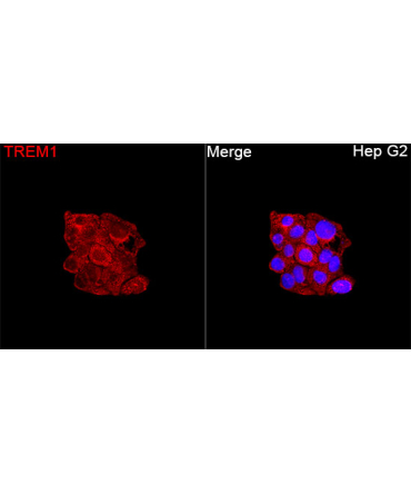 TREM1 Rabbit Polyclonal Antibody