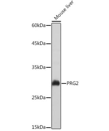 PRG2 Rabbit Polyclonal Antibody
