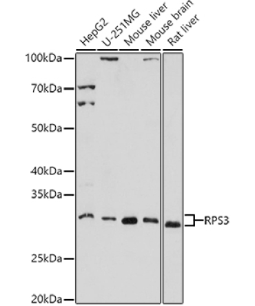 RPS3 Rabbit Polyclonal Antibody