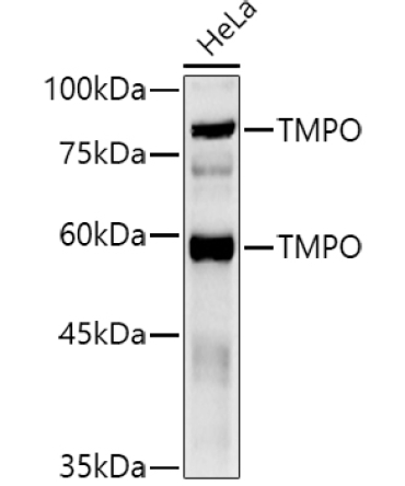 TMPO Rabbit Polyclonal Antibody