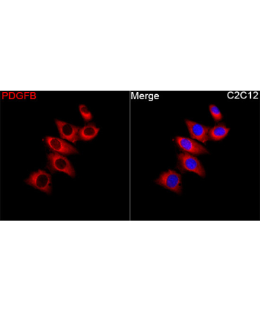 PDGFB Rabbit Polyclonal Antibody