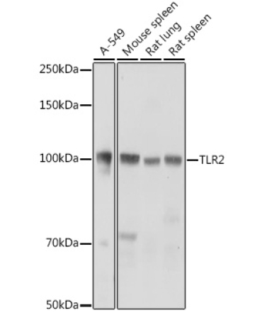 TLR2 Rabbit Polyclonal Antibody