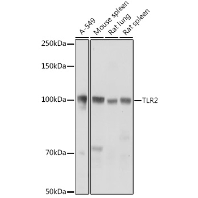 TLR2 Rabbit Polyclonal Antibody
