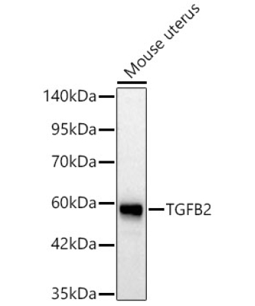 TGFB2 Rabbit Polyclonal Antibody