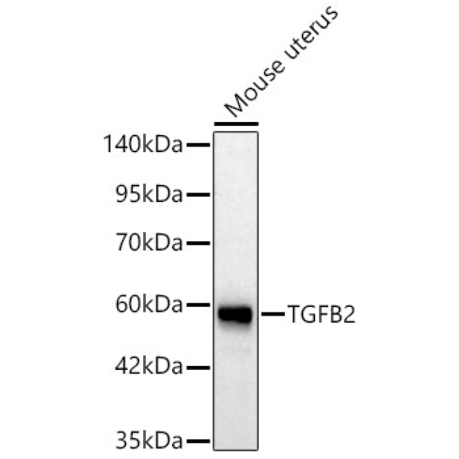 TGFB2 Rabbit Polyclonal Antibody
