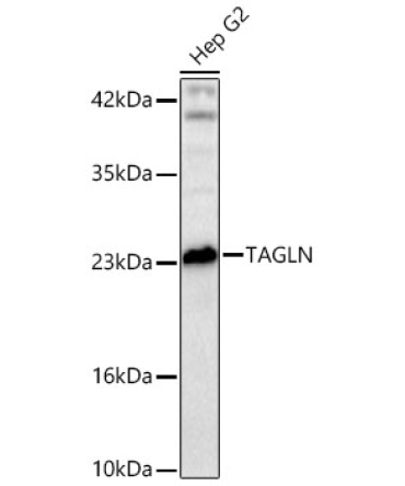 TAGLN Rabbit Polyclonal Antibody
