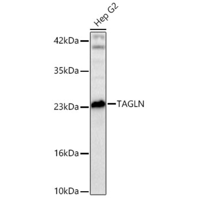 TAGLN Rabbit Polyclonal Antibody