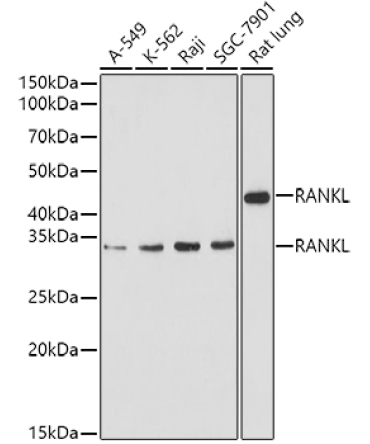 RANKL Rabbit Polyclonal Antibody