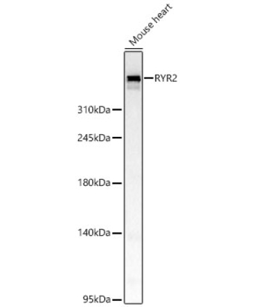 RYR2 Rabbit Polyclonal Antibody