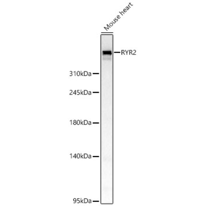 RYR2 Rabbit Polyclonal Antibody