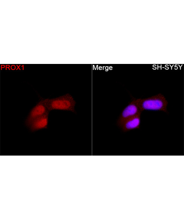 PROX1 Rabbit Polyclonal Antibody