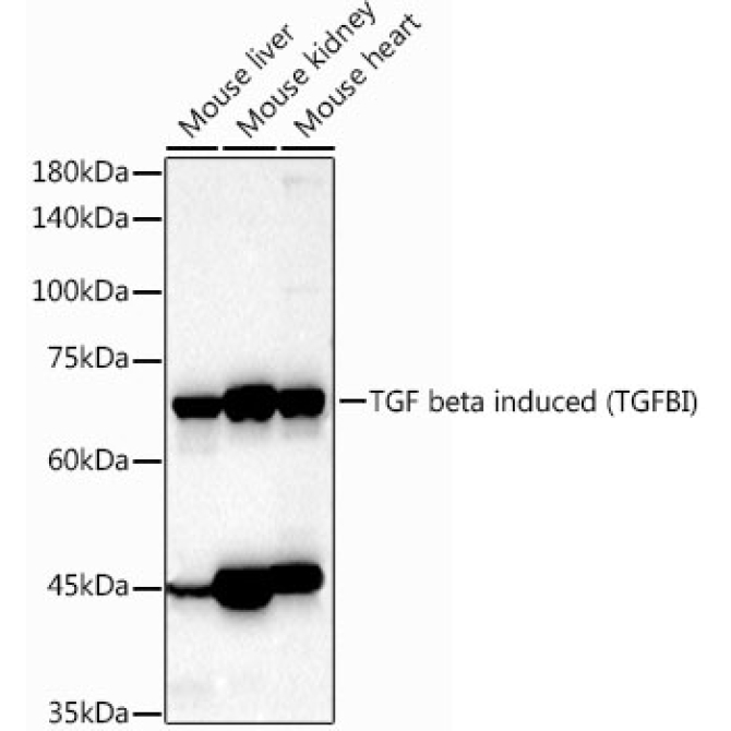 TGF beta induced (TGFBI) Rabbit Polyclonal Antibody