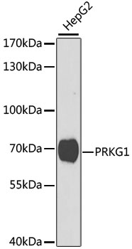 PRKG1 Rabbit Polyclonal Antibody