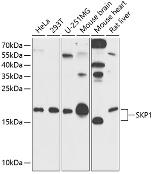 SKP1 Rabbit Polyclonal Antibody