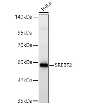 SREBF2 Rabbit Polyclonal Antibody