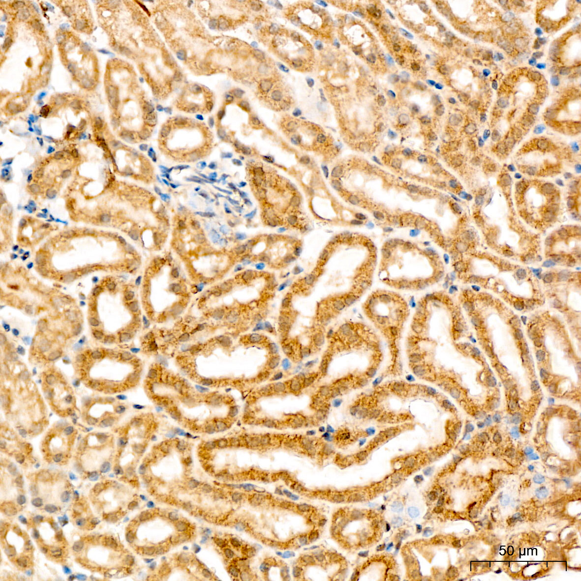 SPHK1 Rabbit Polyclonal Antibody