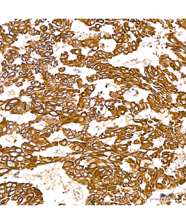 SGPL1 Rabbit Polyclonal Antibody