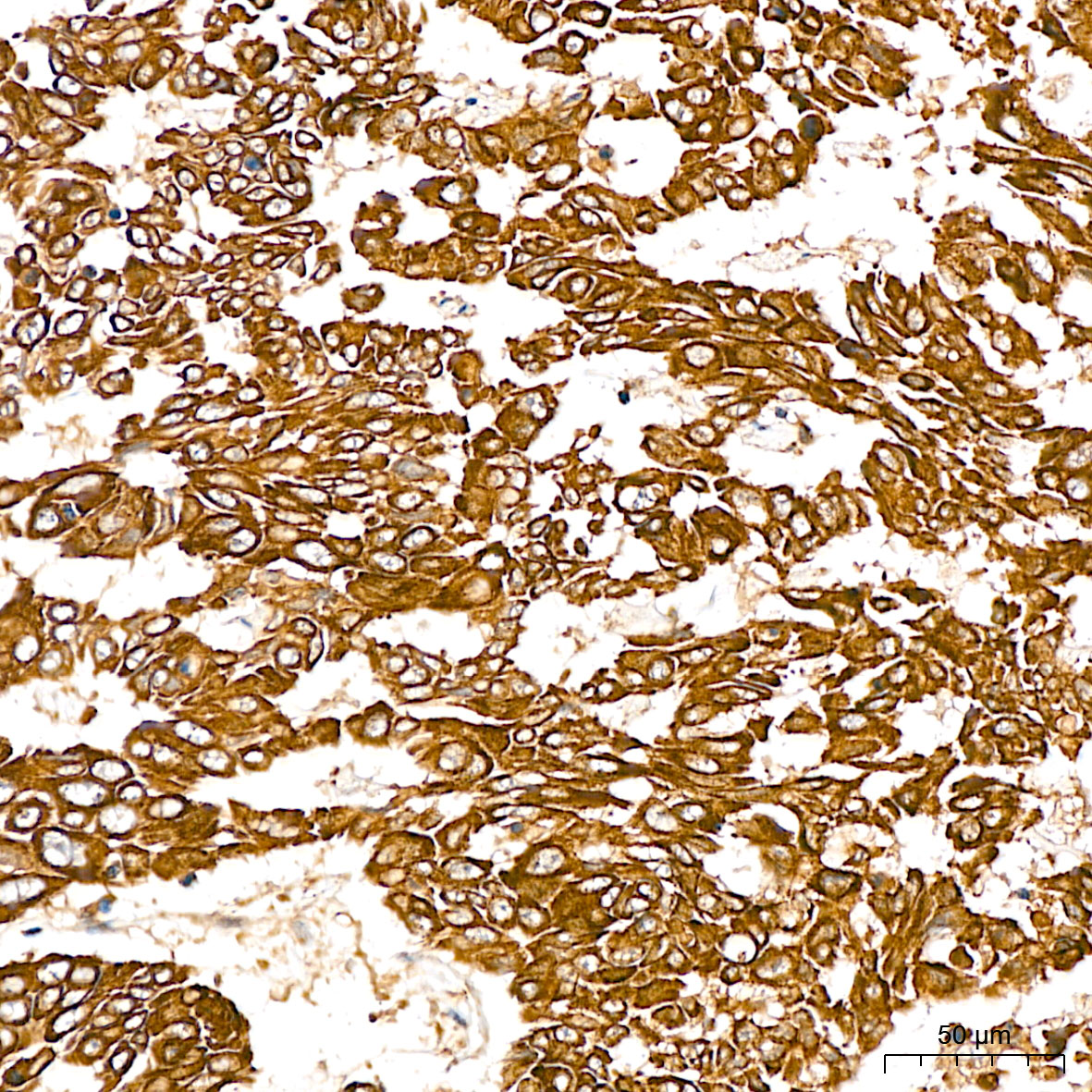 SGPL1 Rabbit Polyclonal Antibody