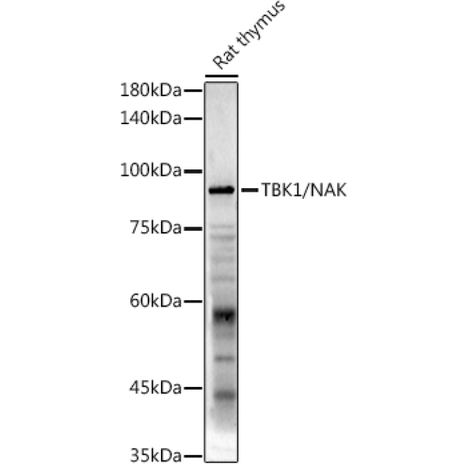 TBK1/NAK Rabbit Polyclonal Antibody