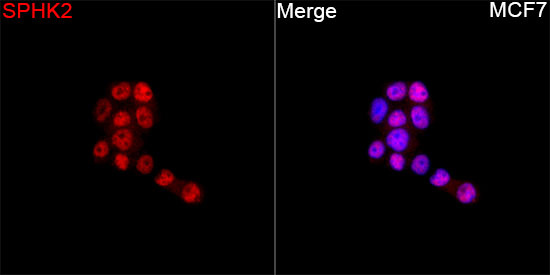 SPHK2 Rabbit Polyclonal Antibody