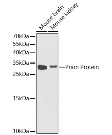 Prion Protein Rabbit Polyclonal Antibody