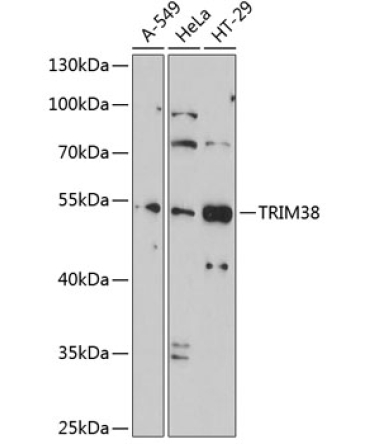 TRIM38 Rabbit Polyclonal Antibody