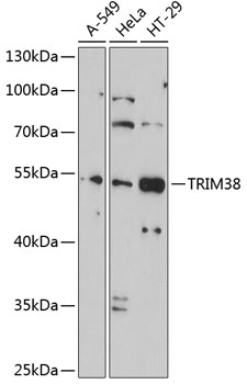 TRIM38 Rabbit Polyclonal Antibody