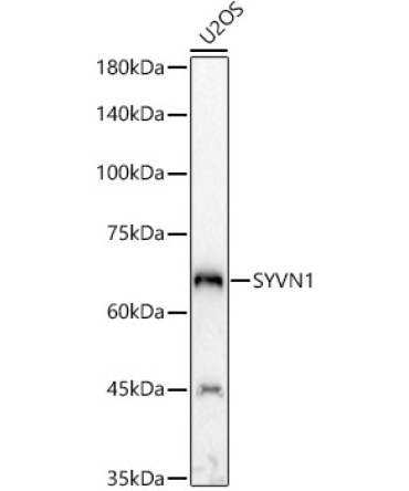 SYVN1 Rabbit Polyclonal Antibody