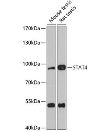 STAT4 Rabbit Polyclonal Antibody