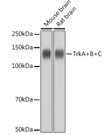 TrkA+B+C Rabbit Monoclonal Antibody