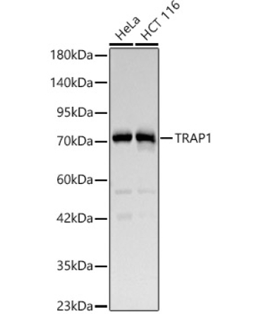 TRAP1 Rabbit Polyclonal Antibody