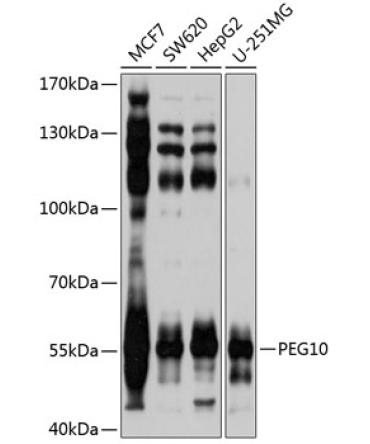 PEG10 Rabbit Polyclonal Antibody