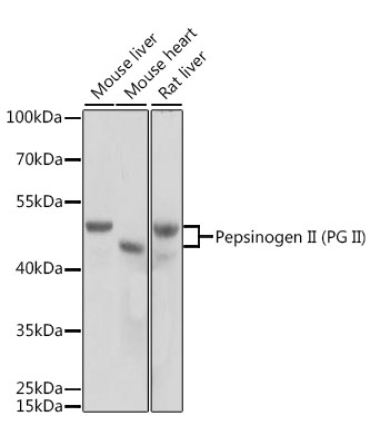 Pepsinogen II (PG II) Rabbit Polyclonal Antibody