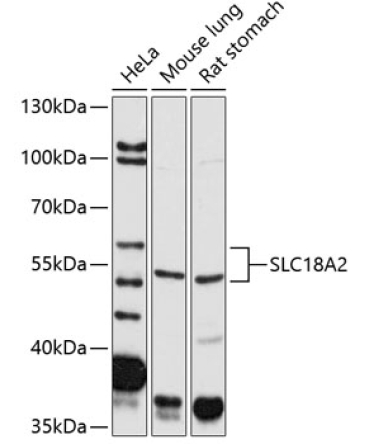 SLC18A2 Rabbit Polyclonal Antibody