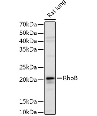 RhoB Rabbit Polyclonal Antibody