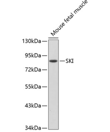 SKI Rabbit Polyclonal Antibody