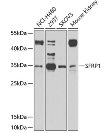 SFRP1 Rabbit Polyclonal Antibody