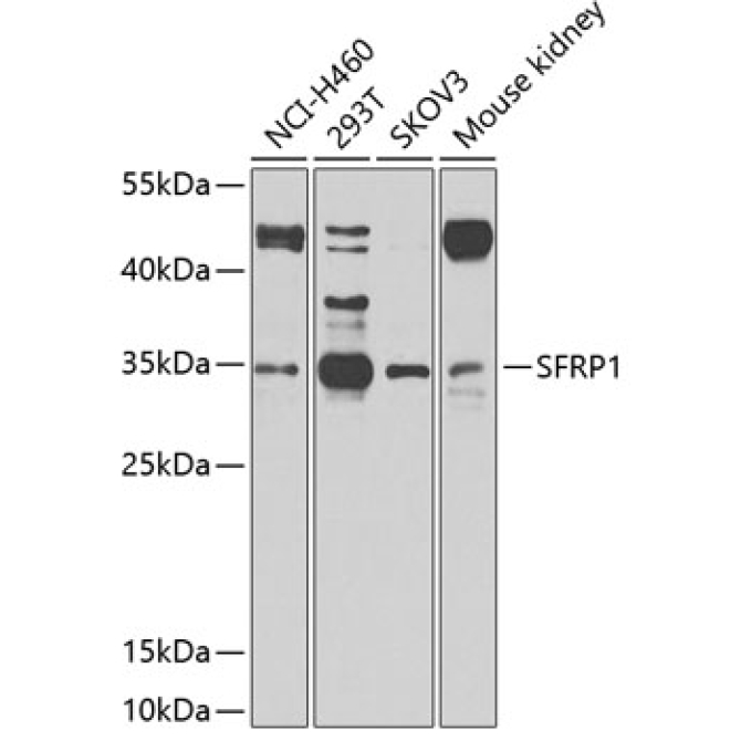 SFRP1 Rabbit Polyclonal Antibody