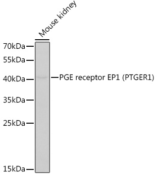 PGE receptor EP1 (PTGER1) Rabbit Polyclonal Antibody